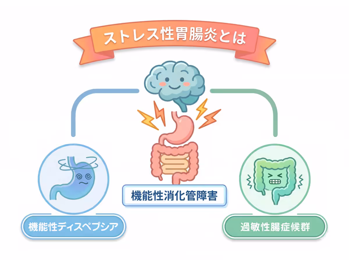 ストレス性胃腸炎