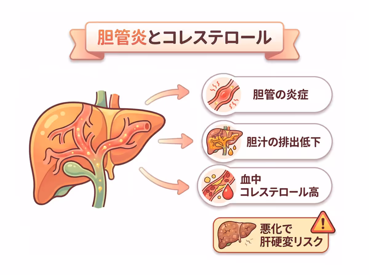 胆管炎とコレステロール