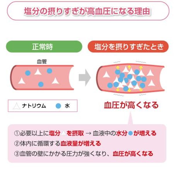 塩分の摂りすぎが高血圧になる理由