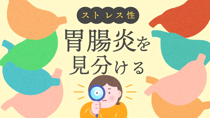 ストレス性胃腸炎の見分け方｜セルフチェックと他の病気との違いのサムネイル