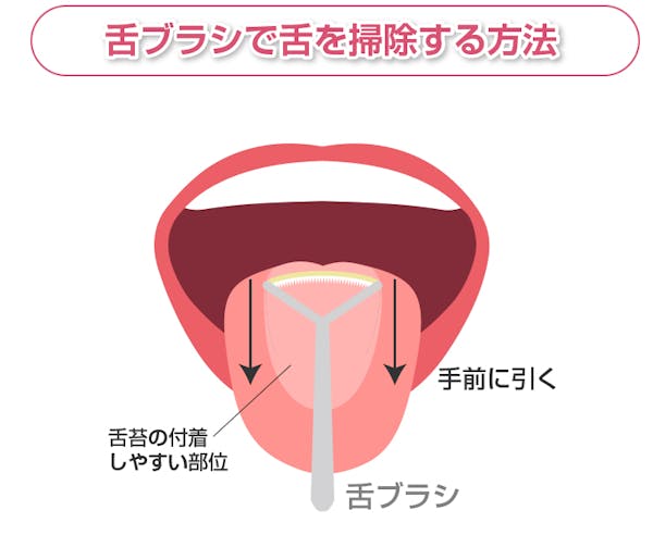 舌苔を除去する