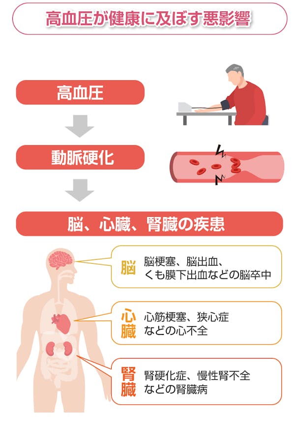 高血圧が健康に及ぼす悪影響