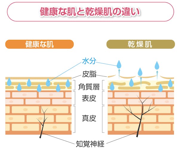 健康な肌と乾燥肌の違いを解説した図