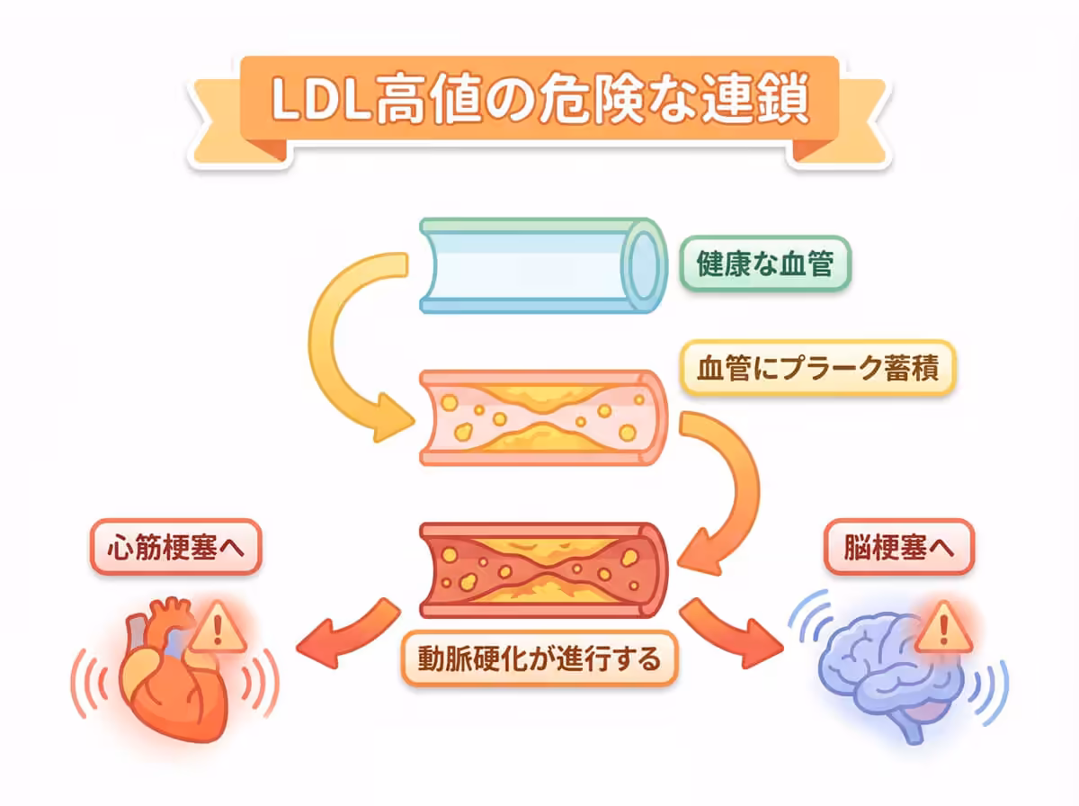 LDL高値の危険な連鎖