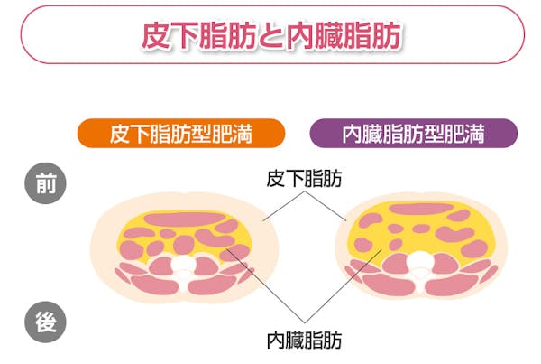 皮下脂肪と内臓脂肪