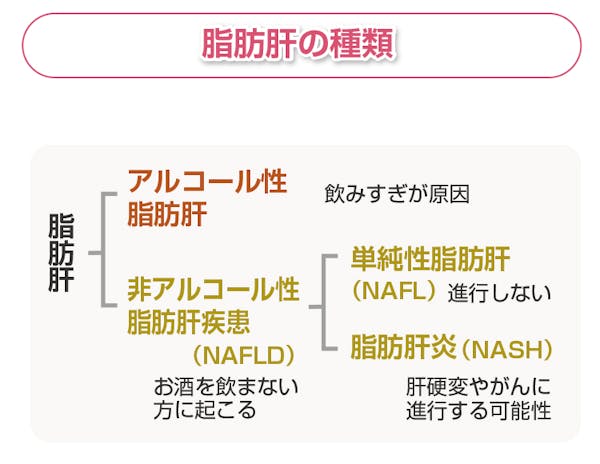 脂肪肝はアルコール性と非アルコール性に大別される