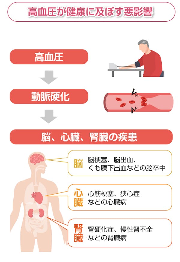 高血圧が健康に及ぼす悪影響