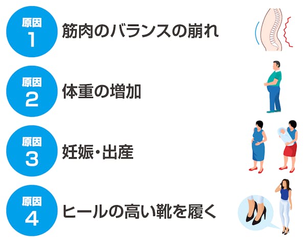 反り腰になる原因
