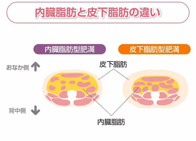 内臓脂肪と皮下脂肪の違い