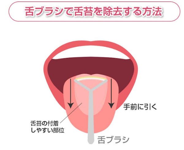 舌苔を取り除く