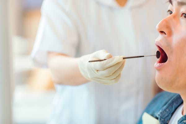 歯の治療を受ける男性