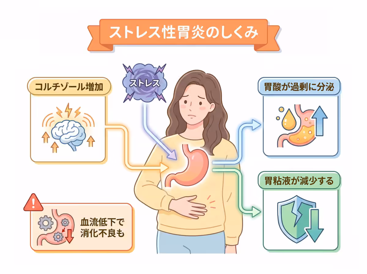 ストレス性胃炎のしくみ