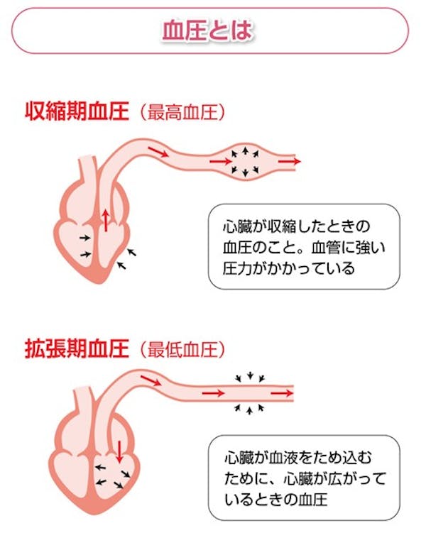 血圧とは