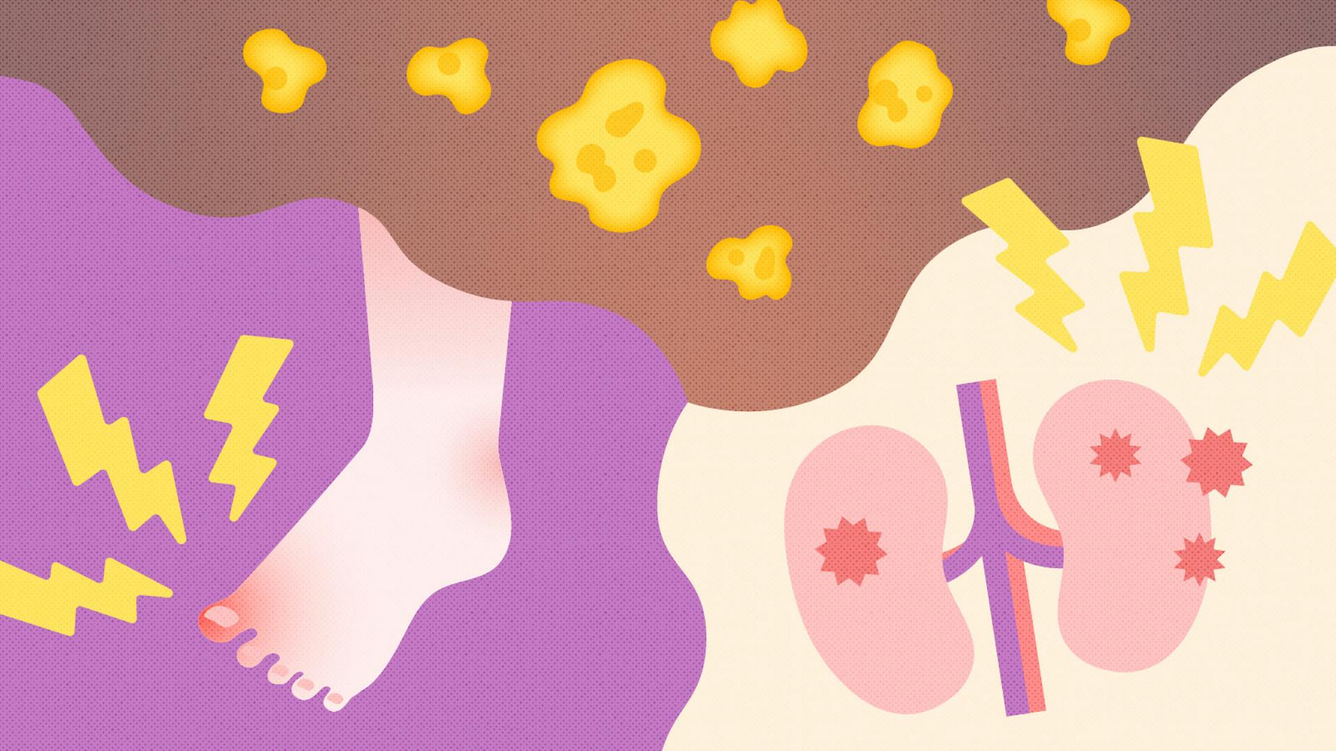 尿酸値とは？基準値や高くなる原因、改善のためのポイントを解説のサムネイル