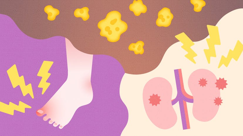 尿酸値とは？基準値や高くなる原因、改善のためのポイントを解説のサムネイル