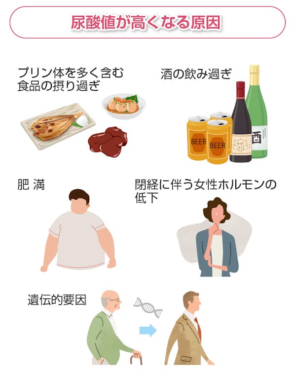 尿酸値が高くなる原因