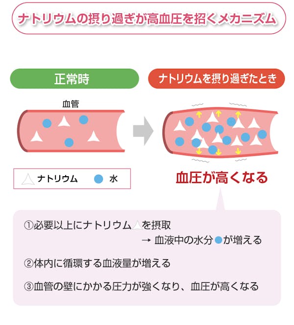 ナトリウムの摂り過ぎが高血圧を招くメカニズム