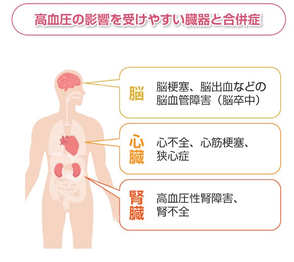 高血圧の影響を受けやすい臓器と合併症