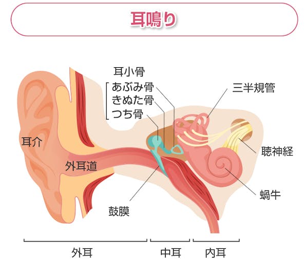 耳鳴り