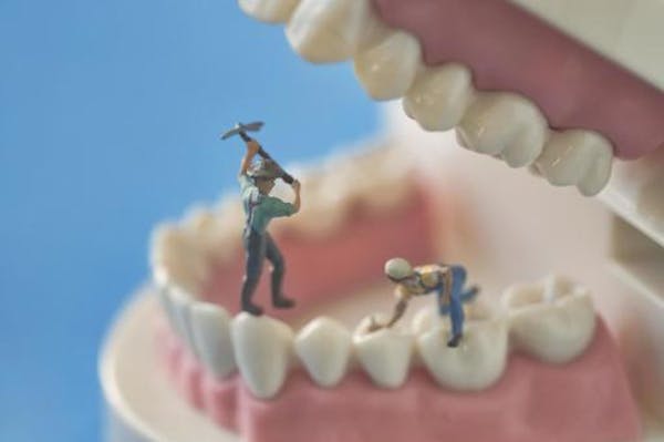 歯の治療をイメージする画像