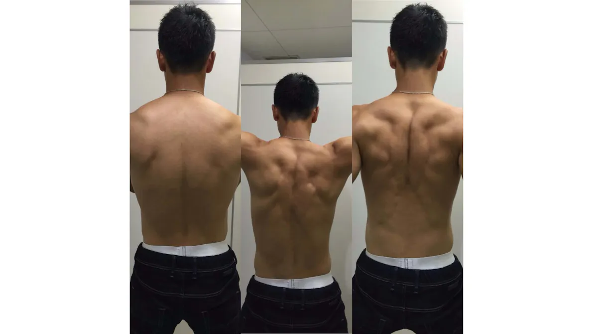 BodyGold(ボディゴールド) 赤坂店の画像